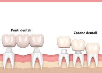 Protesi-Dentale-2