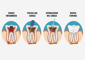 Endodonzia