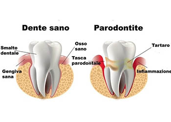 Parodontologia-2