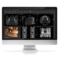 Diagnosi-3d-2